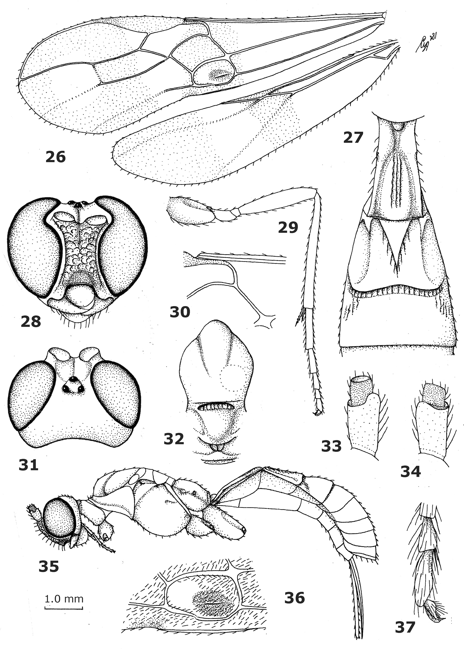 Femoral Sulcus