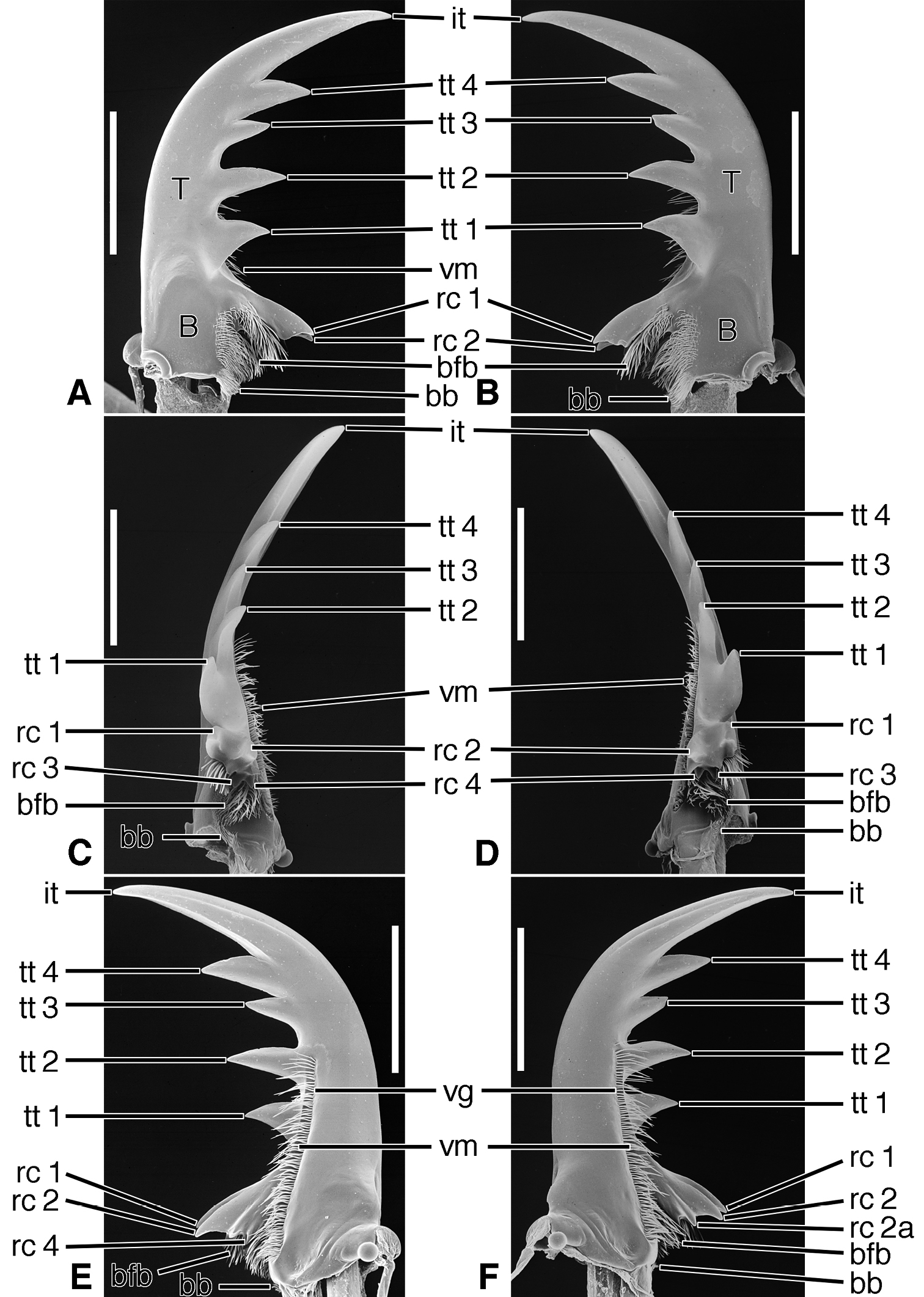 Left Mandible