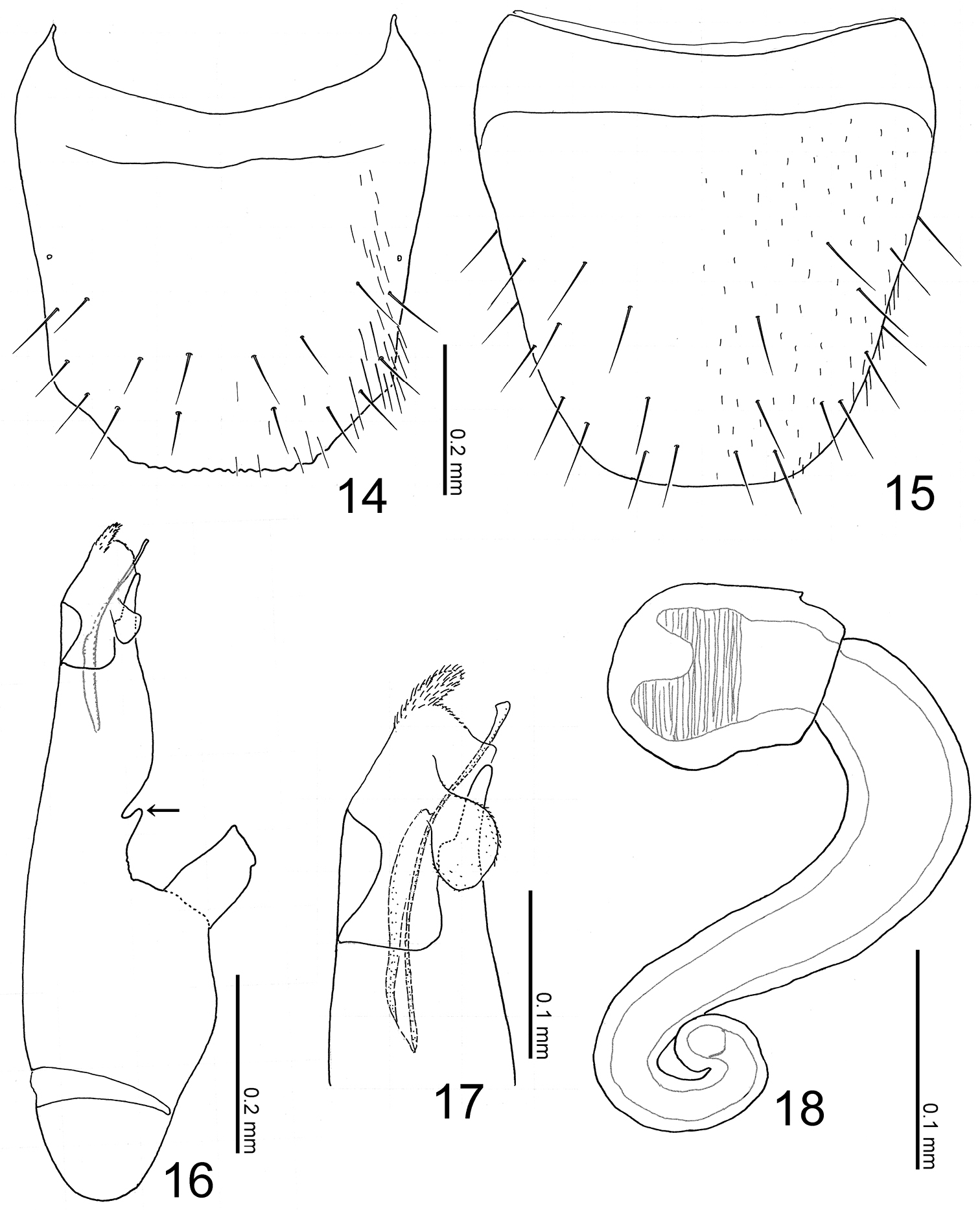 Mandibular Mentum