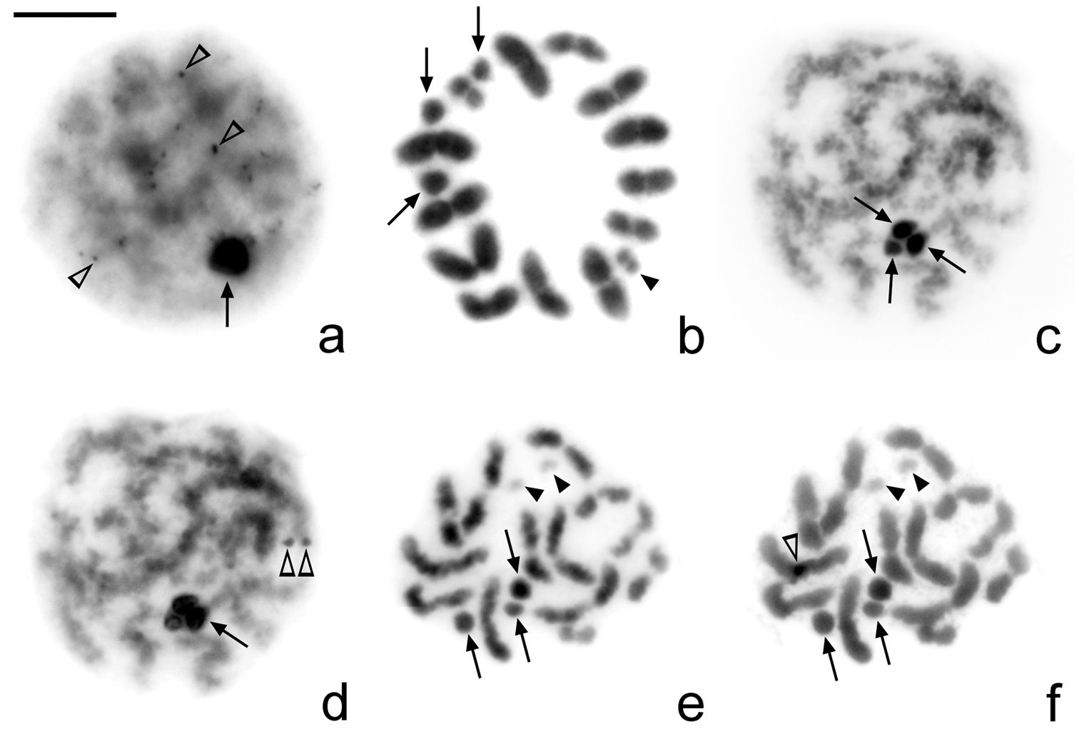 Chromatin Chromosomes