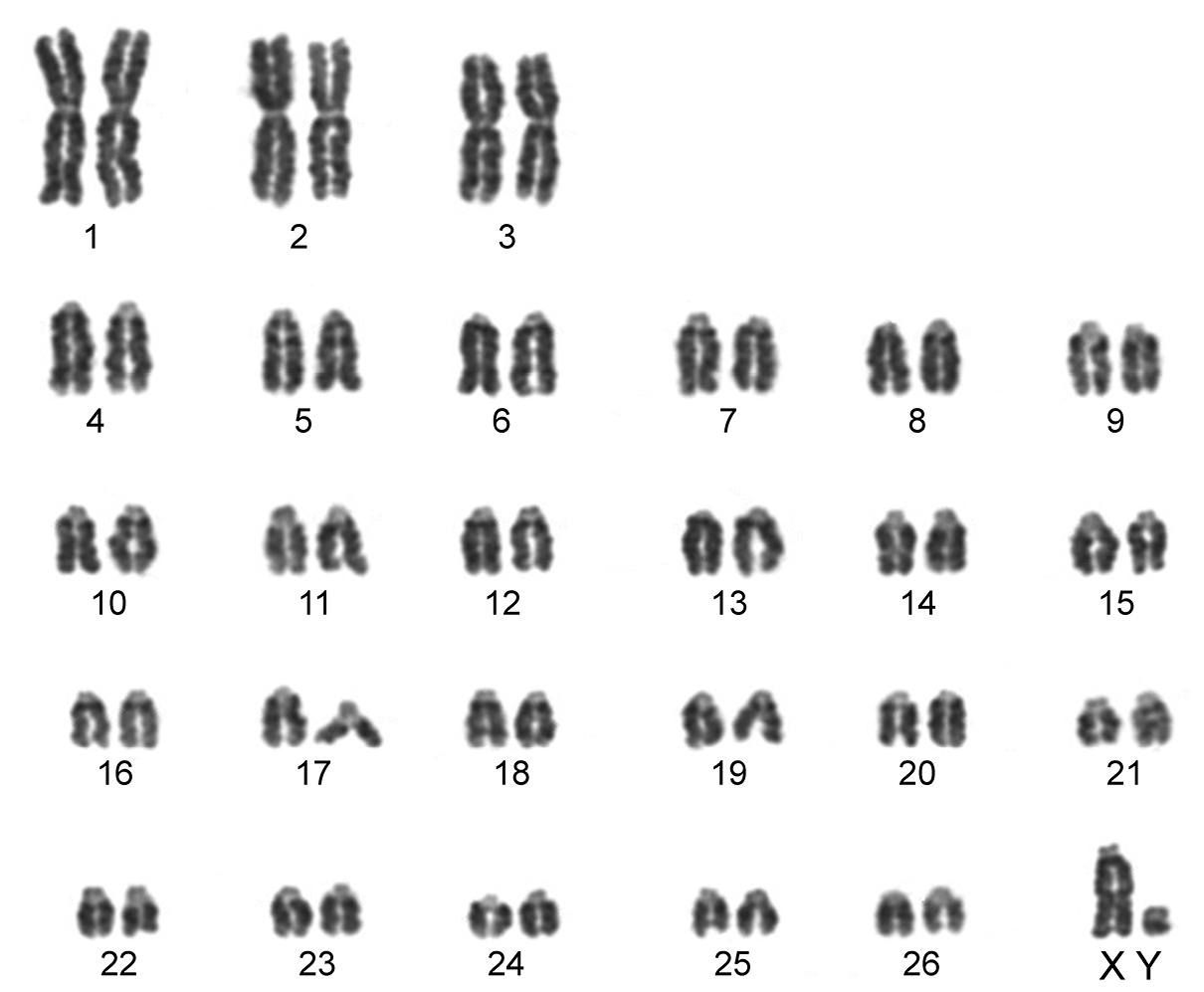 Acrocentric Chromosome