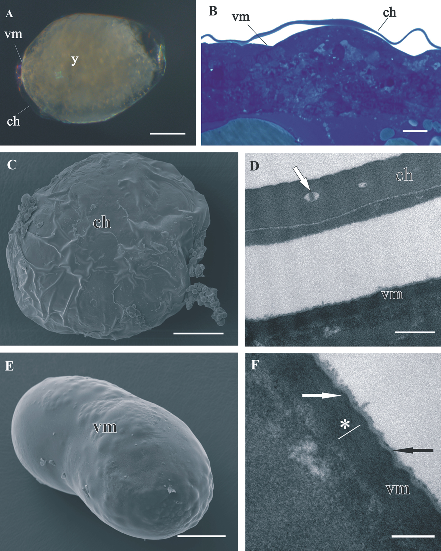 Egg envelopes and cuticle renewal in Porcellio embryos and marsupial mancas